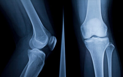 Mandala Medical Group Announces Groundbreaking Limb‑Saving Procedure by Dr. James C. Wittig