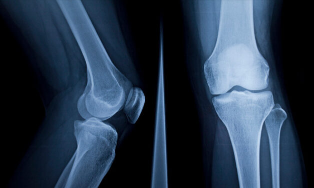 Mandala Medical Group Announces Groundbreaking Limb‑Saving Procedure by Dr. James C. Wittig